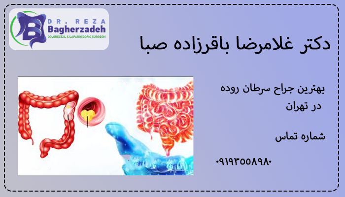 بهترین جراح سرطان روده در تهران